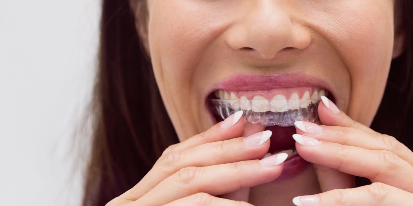 Aligner